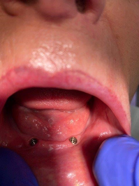dentiste-hossay-belgique (1)