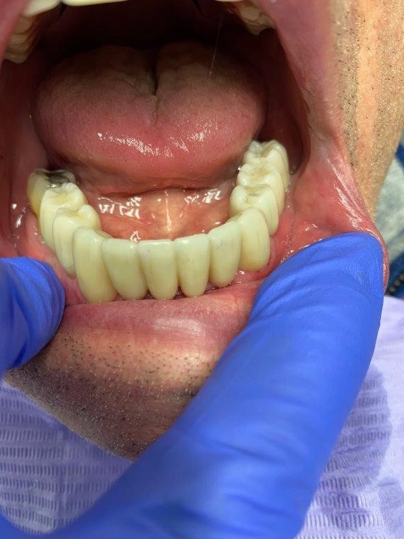 dentiste-hossay-implant-belgique (4)