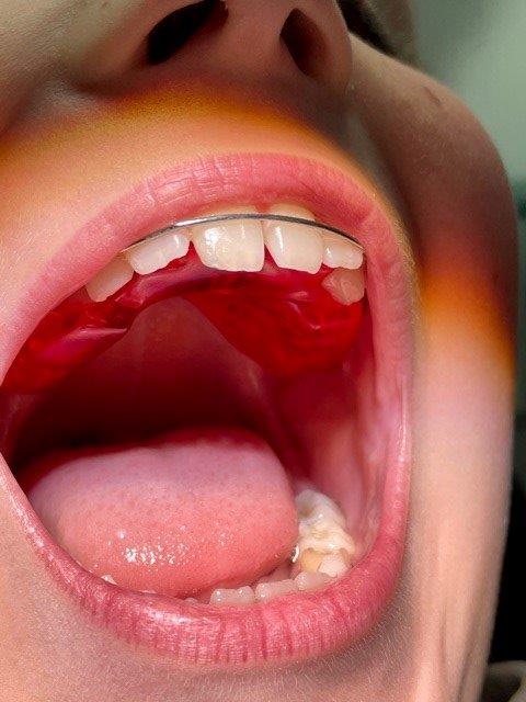 dentiste-hossay-orthodontie1